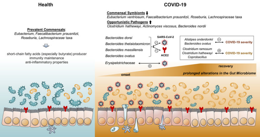 COVID-19-associated diarrhea