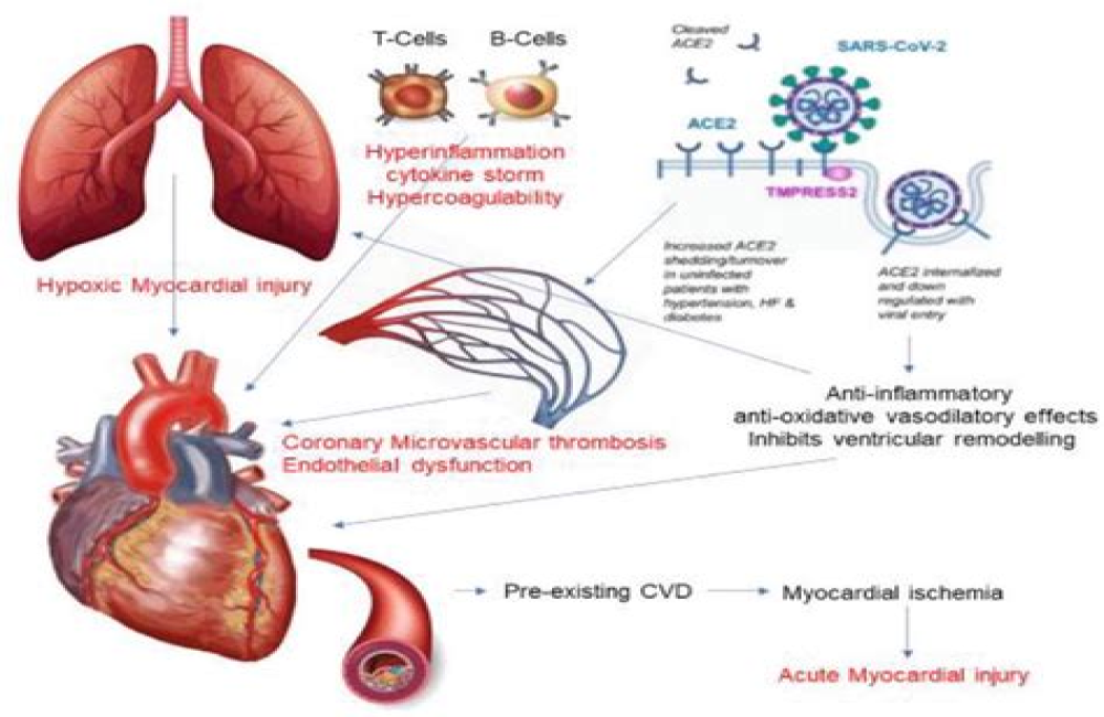 COVID-19 – A vascular disease