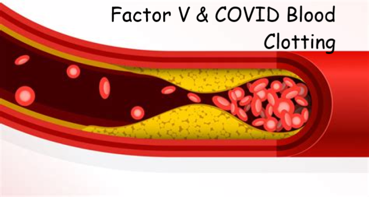 Elevated clotting factor V levels linked to worse outcomes in severe COVID-19 infections