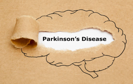 COVID-19 and possible links with Parkinson’s disease and parkinsonism: from bench to bedside